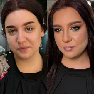 before/after